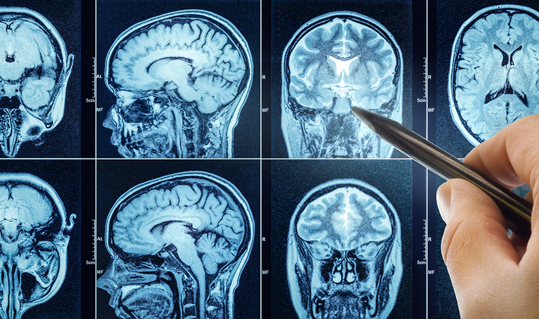 brain scan images